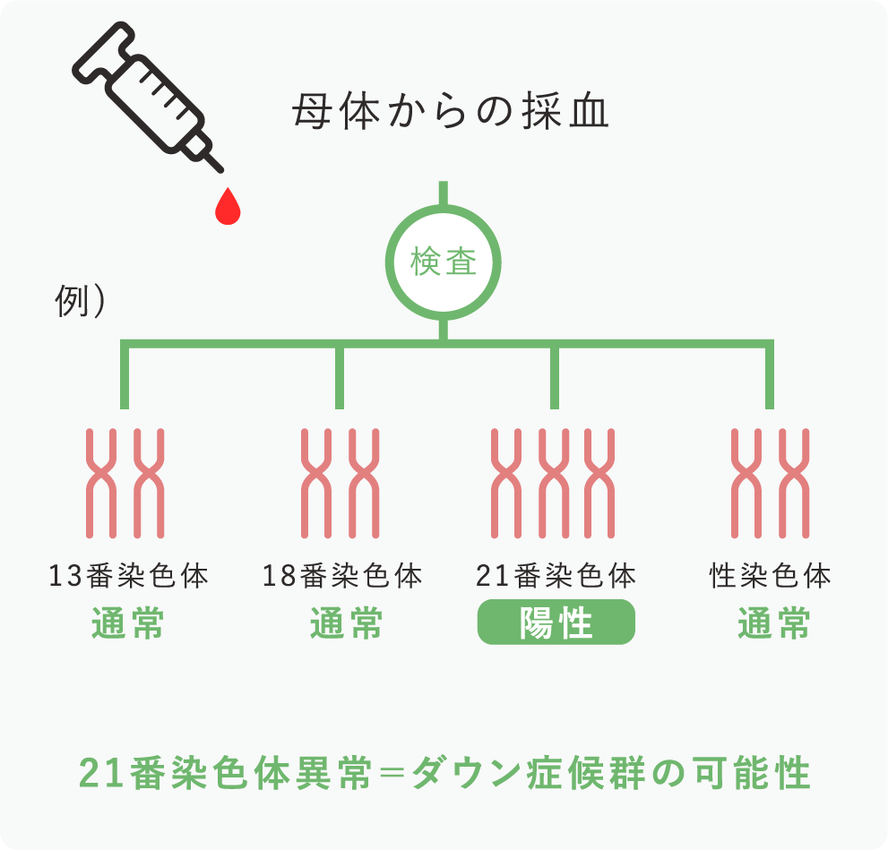 トリソミー検査の概要